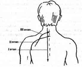 Последовательность линейного массажа при остеохондрозе шейного отдела позвоночника.